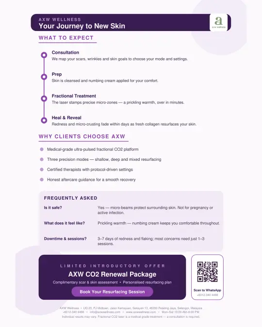 co2-laser-2